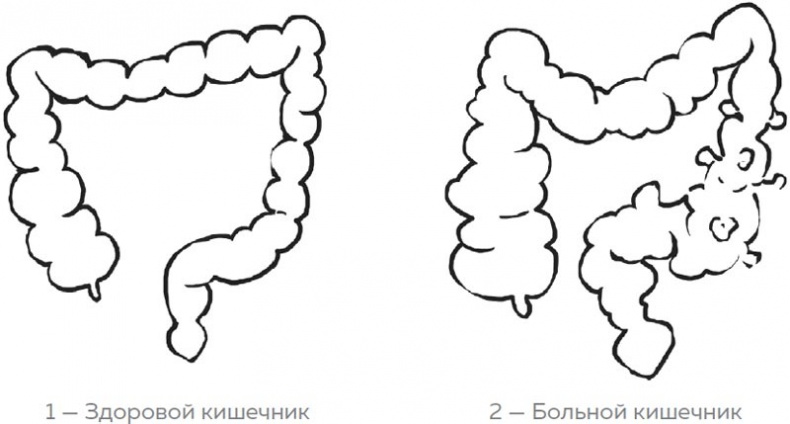 Кишечник. Как у тебя дела? Кишечник. Как у тебя дела?
